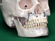 Oral and Maxillofacial Surgery